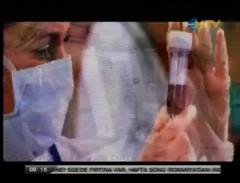 Rahim Ağzı Kanserine Karşı Yapılan Aşı- Dr. Nevzat Melih Gündüz