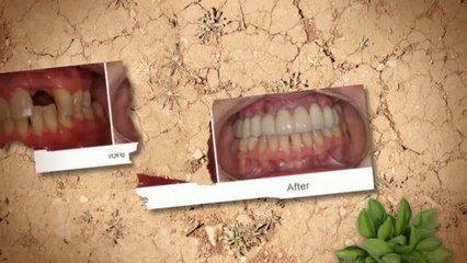 Affordable Dentistry