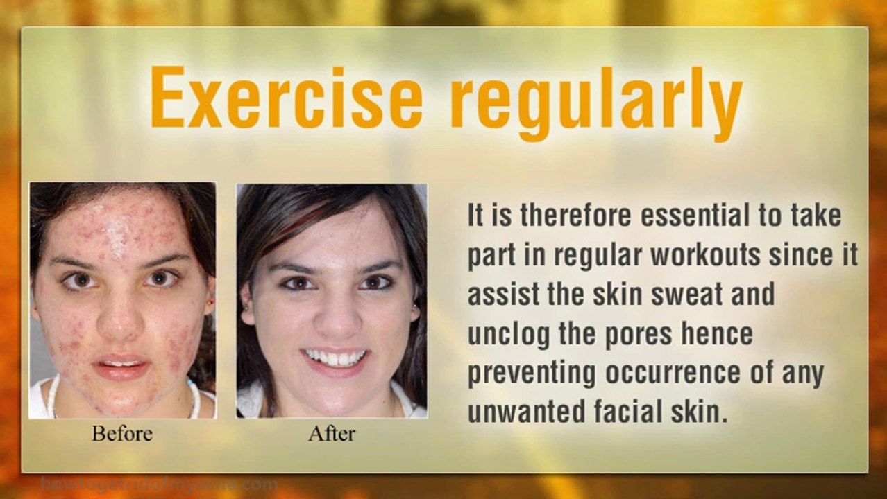 7 Simple Ways to Get Rid of Acne Fast