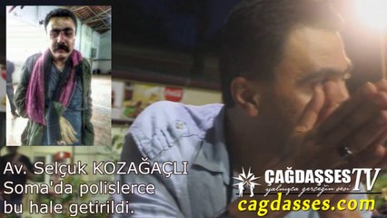 POLİSTEN İŞKENCE GÖREN SELÇUK KOZAĞAÇLI SOMA'DAKİ FACİANIN SEBEBİNİ ANLATIYOR