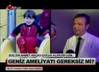 Doç.Dr.Ahmet Akçay Kanaltürk anahaber'de geniz eti ameliyatı bilgilendirmesi