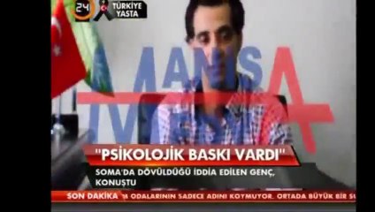 Başbakan'ın Dövdüğü Gencin Yeni Açıklaması (Döver de Sever de)
