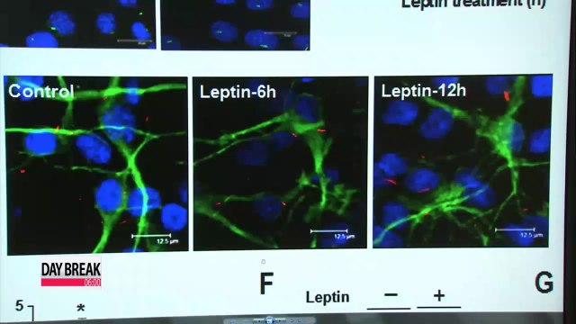 Mystery of obesity cause discovered