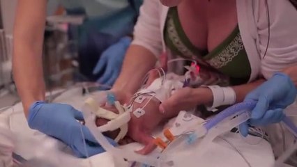 First Year Of A Baby Born 3.5 Months Premature!!