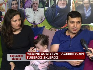 TUBEROZ SKLEROZ HASTALIĞI VARDI ŞİFALI BİTKİLERİ KULLANDI