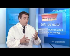 Clinicas Vitaldent Málaga y el sistema de carga inmediata