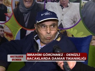 BACAKLARDA DAMAR TIKANIKLIĞI HASTALIĞI VARDI ŞİFALI BİTKİLERİ KULLANDI