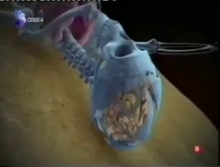 Matrimonio: Caida mortal (TCE)