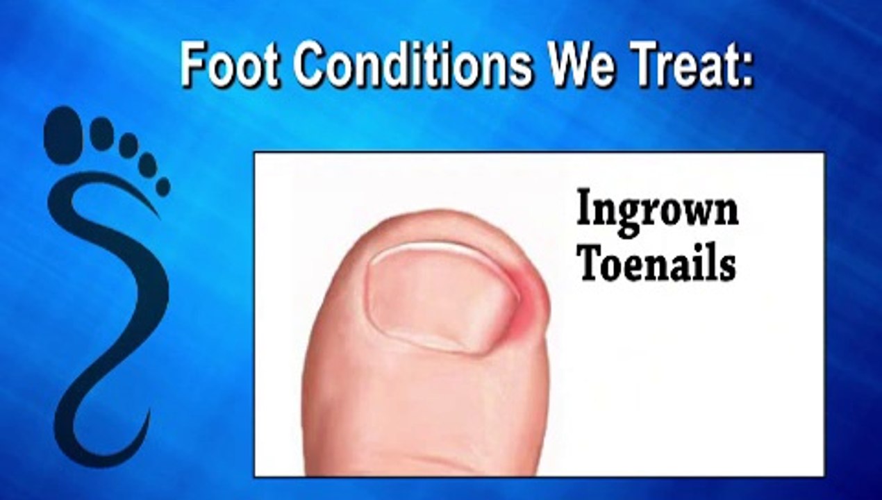 Connecticut Foot Care Centers  - Podiatrist in Newington, Glastonbury and Kensington, CT -