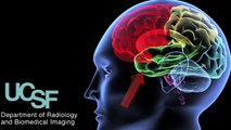 UCSF Radiology- Exploring the Effects of Concussions On the Brain