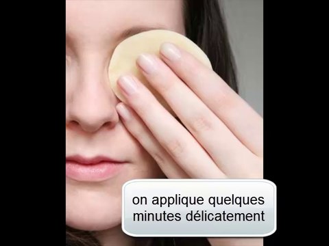 astuce beauté anti cernes - Carine Chambre
