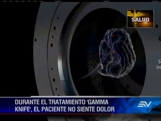 salud Tumor cerebral