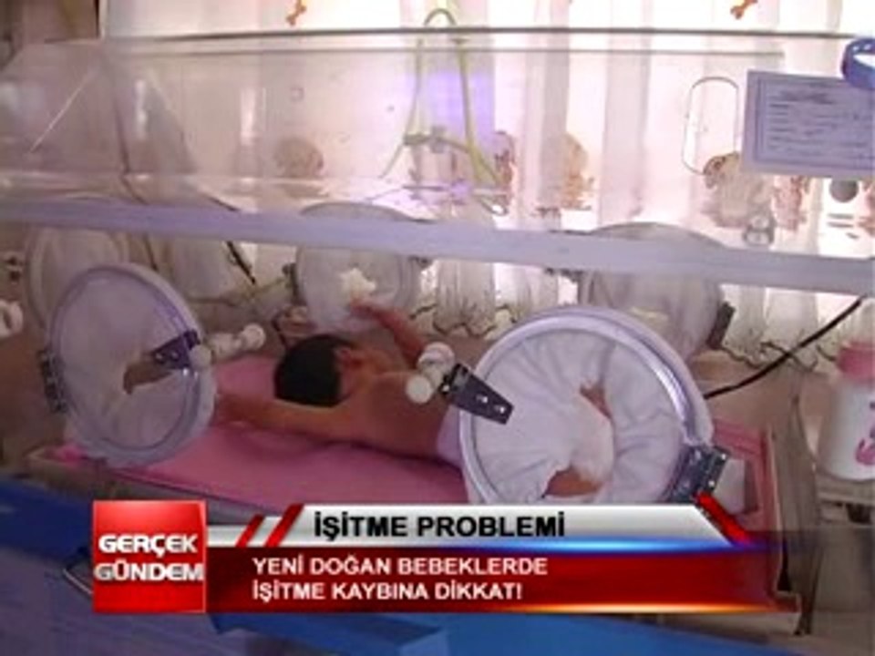 İŞİTME PROBLEMİ 03 01