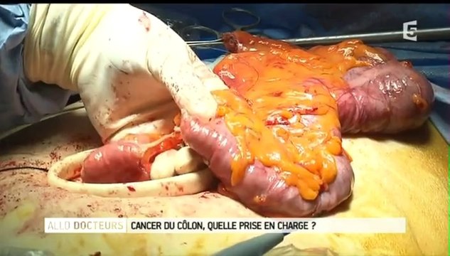 Allô, docteurs !_France 5_2014_05_22_14_41