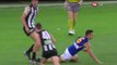 Australian Football player loses teeth after massive collision