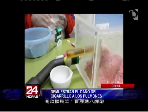 China: expertos demuestran los nocivos efectos de los cigarrillos en los pulmones