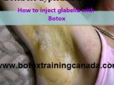 How to use Botox for hyperhidrosis