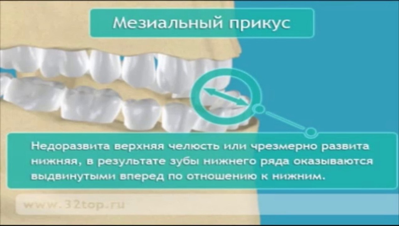 Прикус
