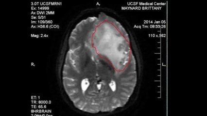 Cancer patient releases video explaining move to Oregon for assisted suicide