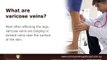 How To Prevent Varicose Veins in Winter