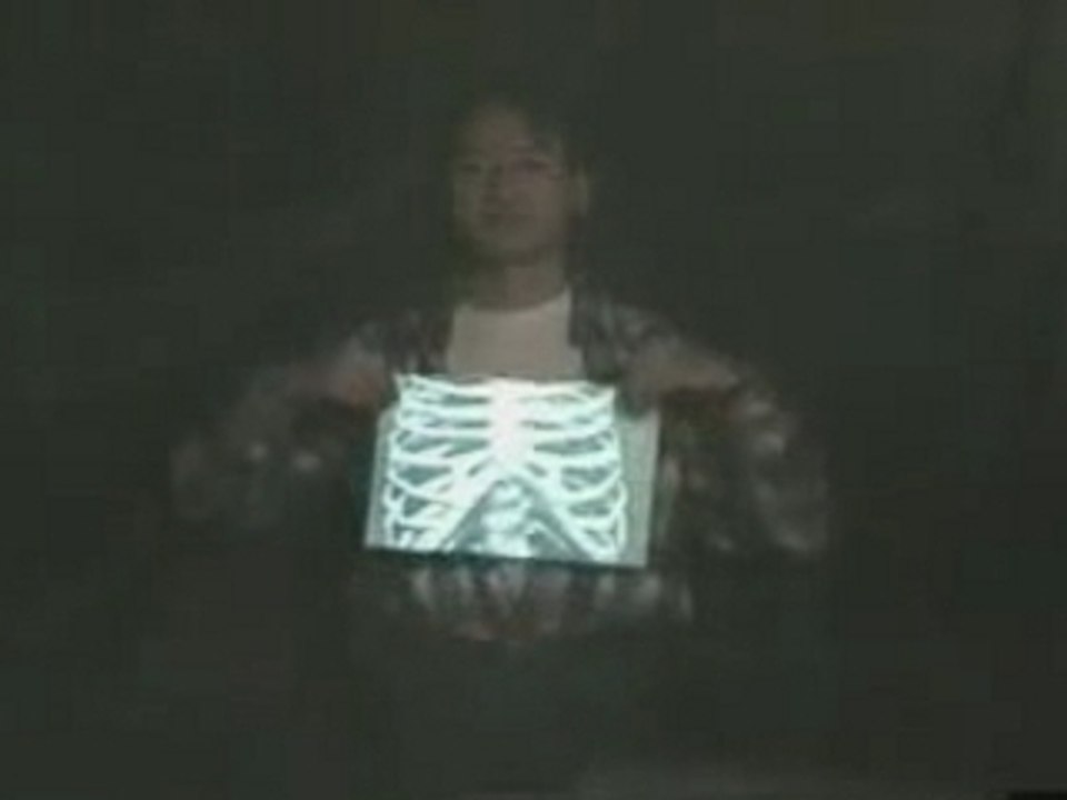 Bone2