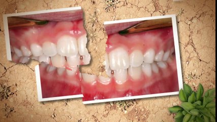 Thornton Orthodontist May2014