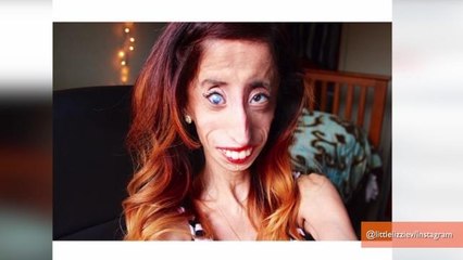 Woman Called 'The Ugliest Woman In The World' is Making a Movie