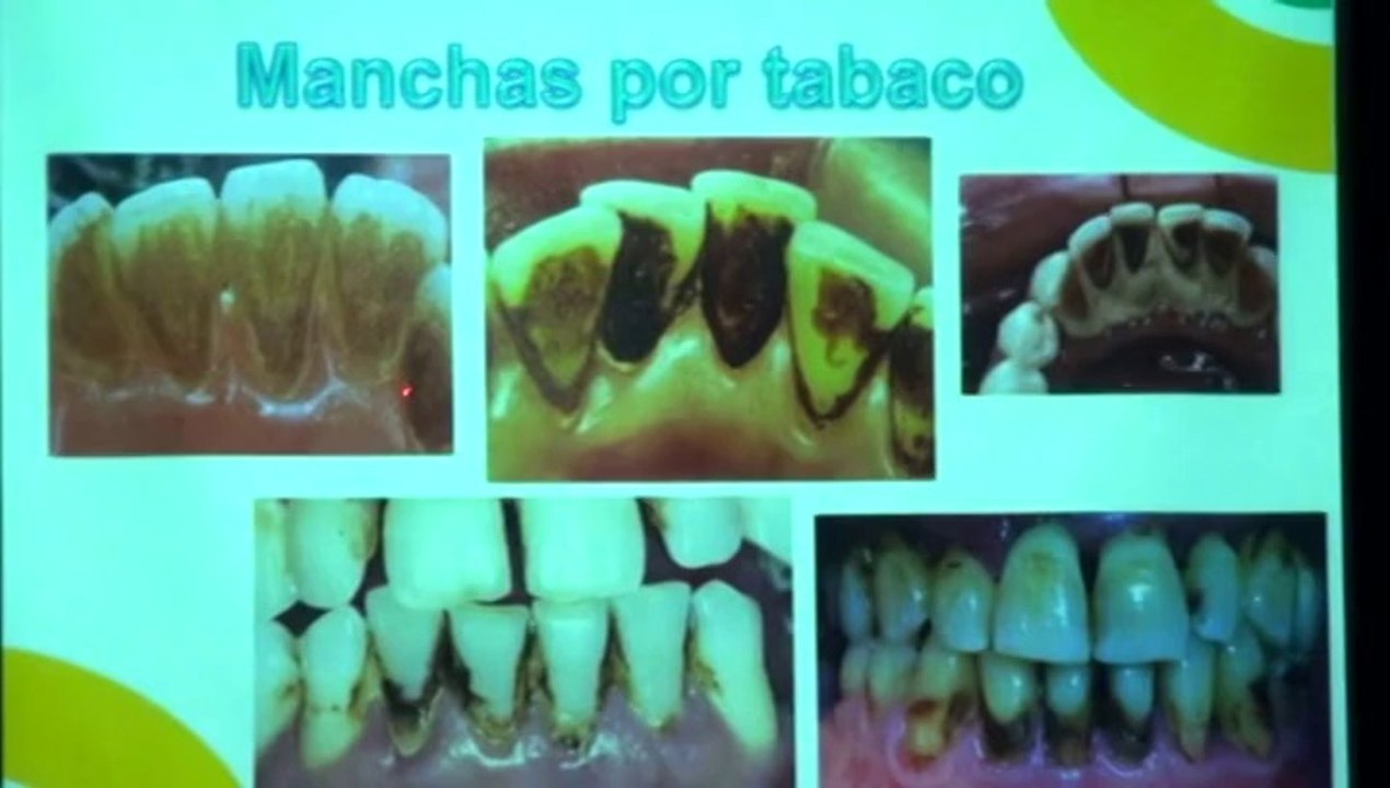 La Concejalía de Asuntos Sociales de Leganés celebró varias actividades en el Día Mundial SIN Tabaco