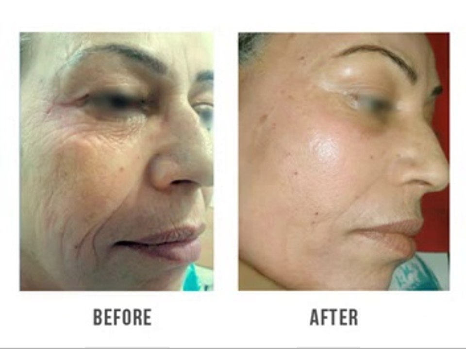 Dr GVG - Anti Aging Clinic Launch