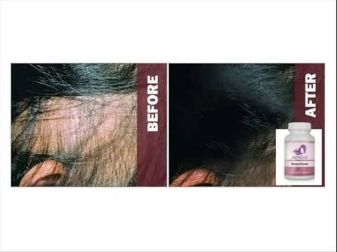 Provillus in Pakistan Call 0321-5162796