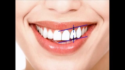 Эстетическая стоматология