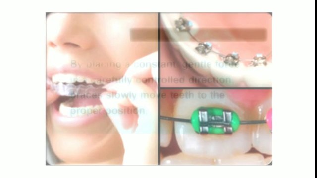 Canton Orthodontist May2014