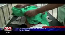 Yurimaguas: dos flechas se incrustan por accidente en la pierna de un niño
