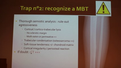 Bone Tumors In Children What Should We Know - Saliha Djebbar - Tuesday 28th January 2014 - Part 1