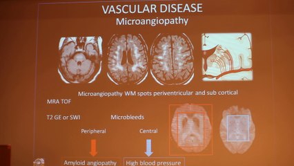 MRI And White Matter - Françoise Héran - Wednesday 29th January - Part 1