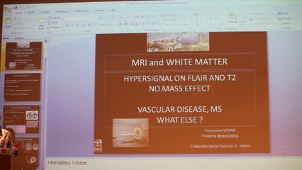 MRI And White Matter - Françoise Héran - Wednesday 29th January - Part 2