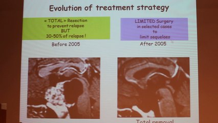 Brain Tumors In Children - Nathalie Boddaert - Wednesday 29th January - Part 2