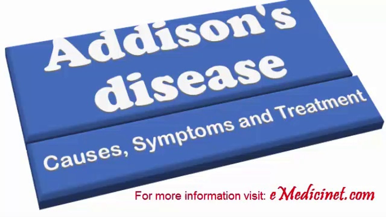 Addison's Disease - Causes, Diagnosis, Symptoms and Treatment
