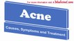 Acne - Causes, diagnosis and treatment
