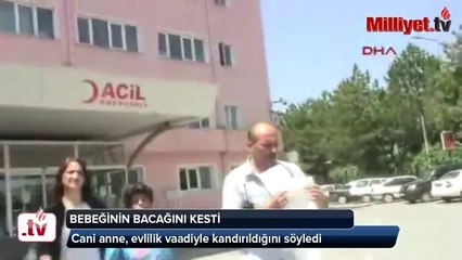 Bebeğinin bacağını kesen anne konuştu -KonyaMesaj