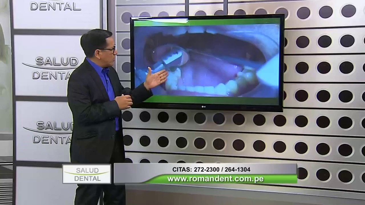 Salud Dental: conozca los síntomas y tratamientos para curar las caries