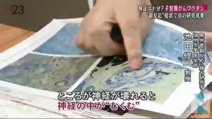 子宮頸がんワクチン、“副反応”症状で初の研究成果