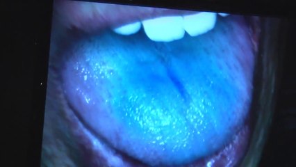 ‪Tested: Is Norm a Supertaster?‬