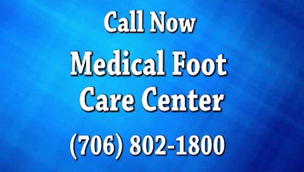 Rome, GA - Bunions -  Podiatrist Brian Middleton, DPM