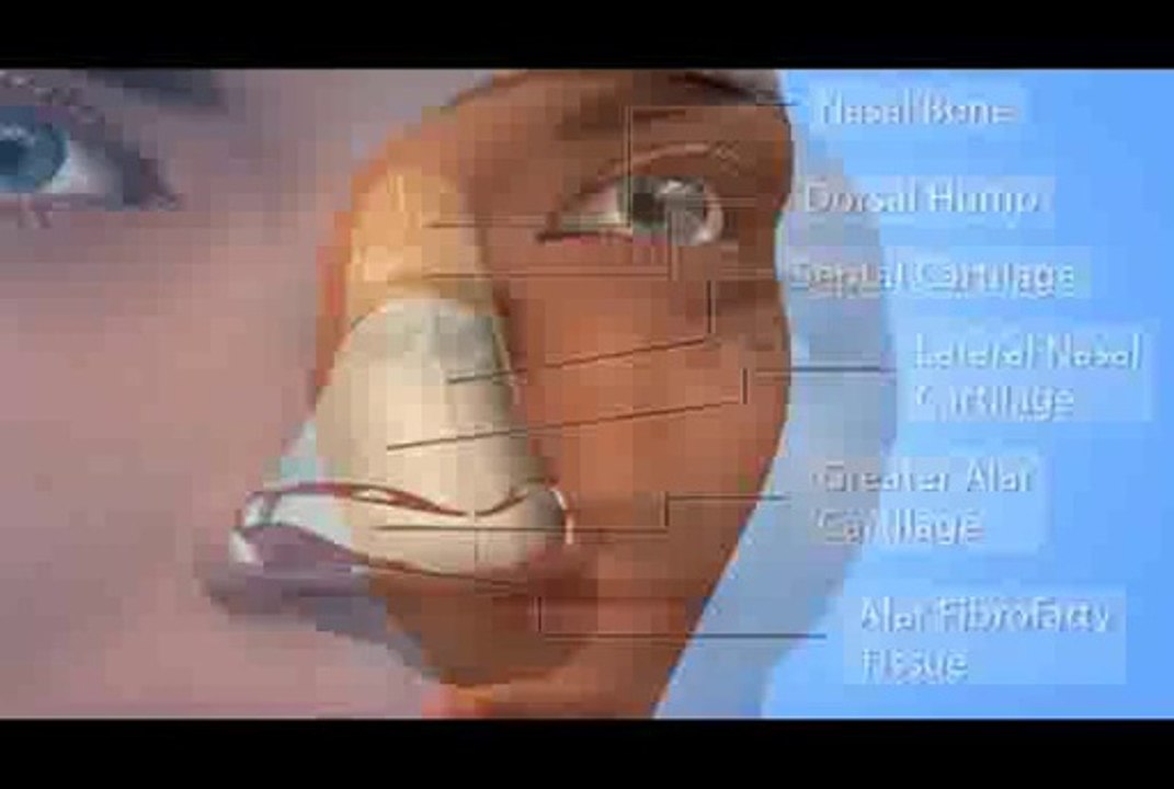 Rhinoplasty Nose Job Surgery