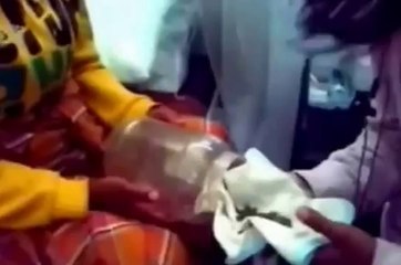 SHOCKING Video Shows Woman giving Birth to a LIZARD in Indonesia!!