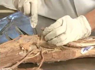 Superficial and Deep muscles of front and back of forearm