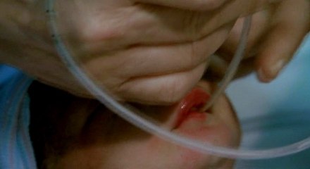 Doğduğunda nefes alamayan bebeğe ilk yardım