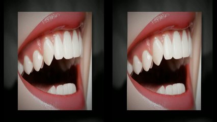 Orthodontist Frisco TX - Call (214) 618-6444