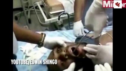 Boğazına akıllı telefon kaçan adam